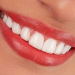 Dents saines