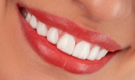 Dents saines