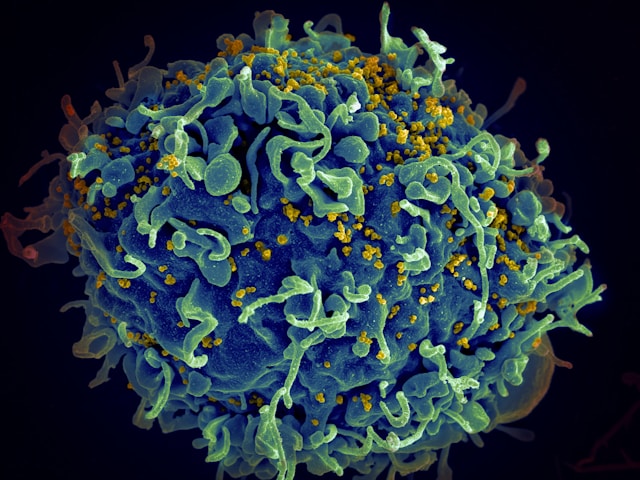 Le rôle du microbiote dans le bien-être général
